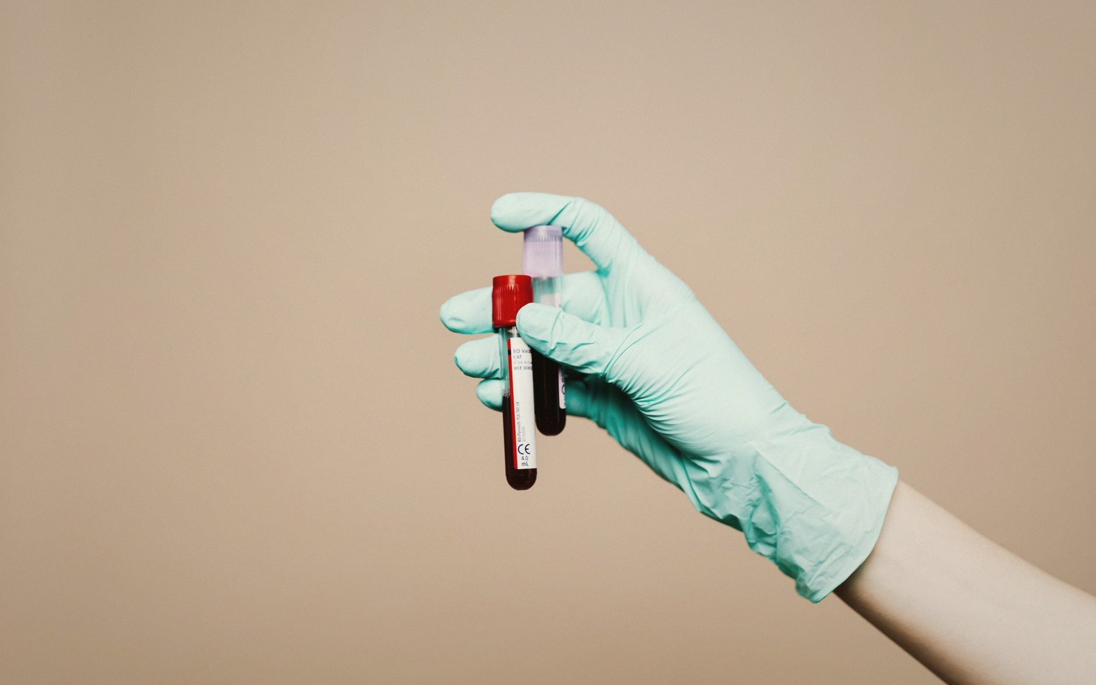 What a Blood Test Is Looking For